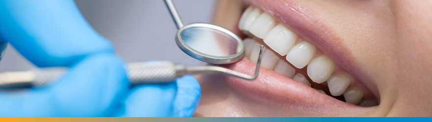 lente de contato dental