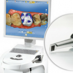 Cad Cam Scanner – o que é e como funciona?