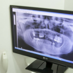 Odontologia moderna – ela é possível nos pequenos centros urbanos!