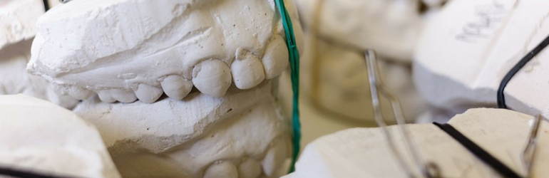 moldagem odontológica