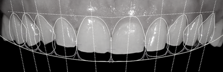 Digital Smile Design